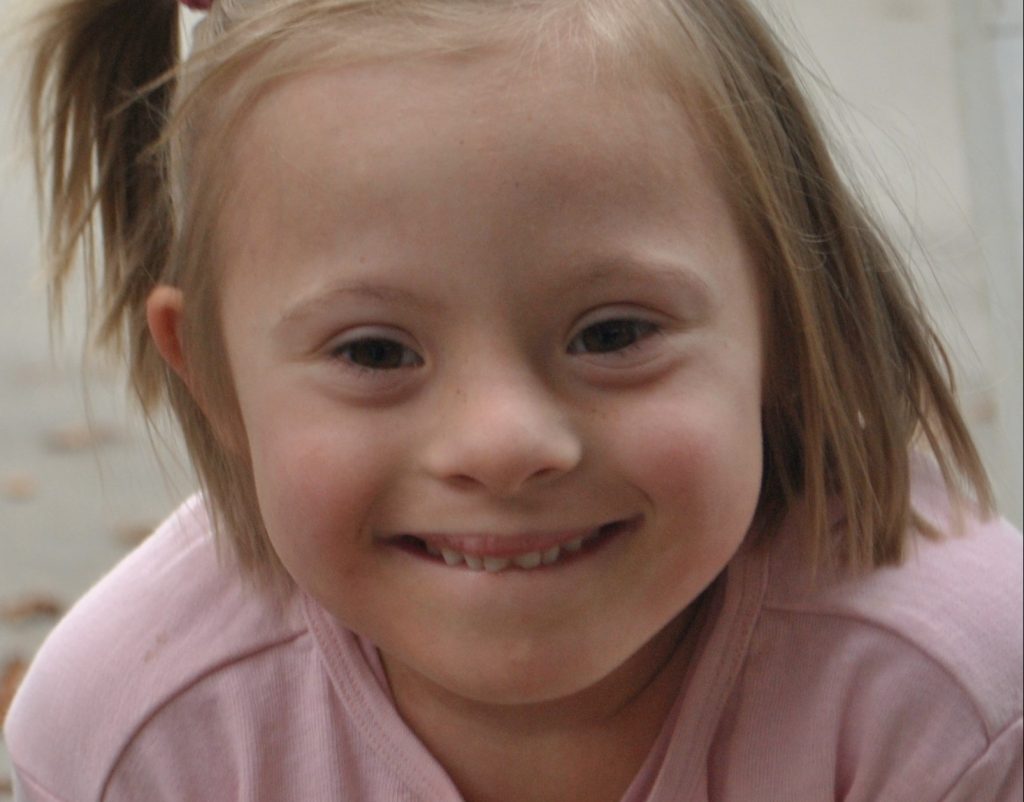 Ein Mädchen mit angeborem Handicap